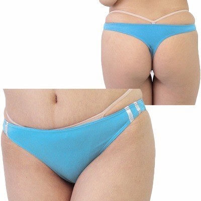 �Q�������X�g���b�`�u���}�s�o�b�N�@�^�[�R�C�Y